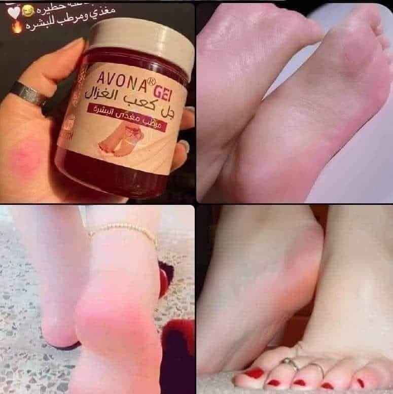 كعب غزال 1